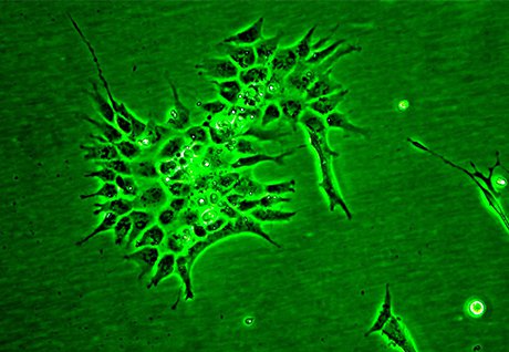 Pflanzenzellen Mokroskopansicht grün.jpg